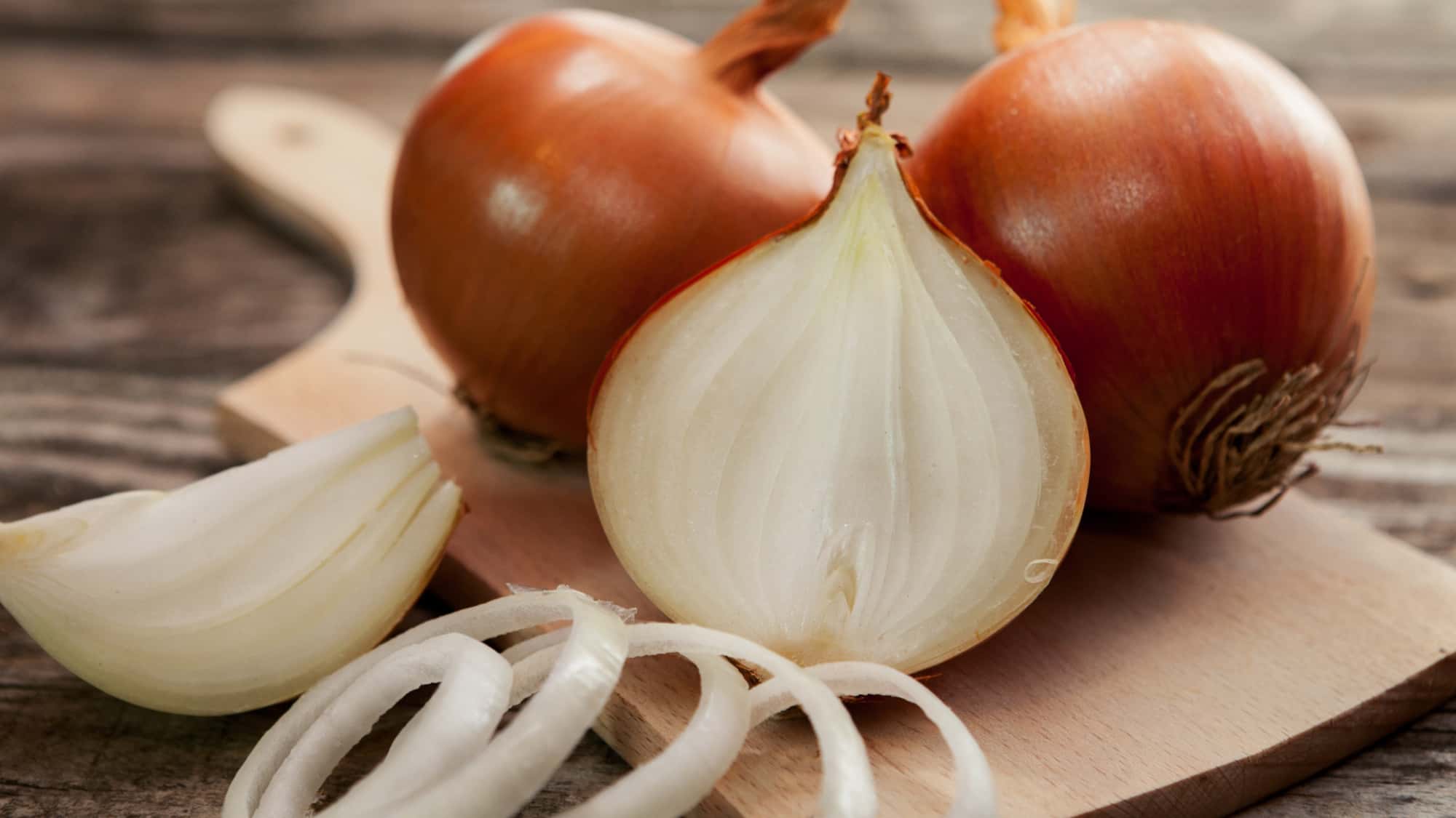 wie viel kalorien hat eine zwiebel