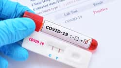 Ein positiver Coronatest bedeutet, dass du dich in Isolation begeben musst