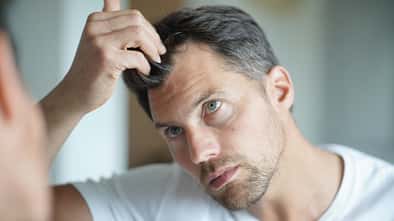 Finasterid gegen Haarausfall