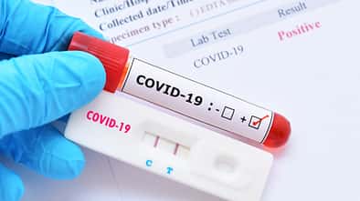 Ein positiver Coronatest bedeutet, dass du dich in Isolation begeben musst