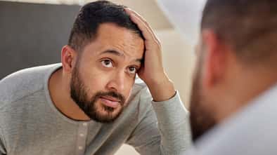 Haarausfall bei Männern Haarausfall bei Männern