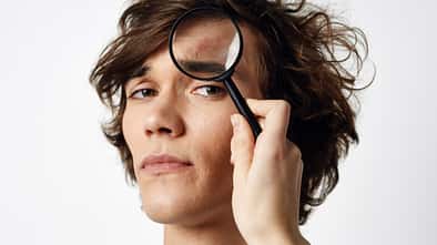 Die besten Tipps gegen Akne