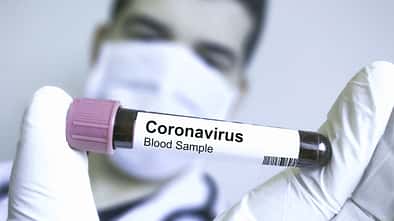 So schützt du dich wirklich vor dem Coronavirus