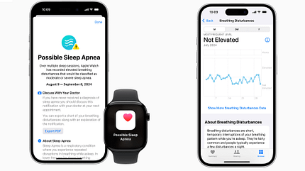 Die Apple Watch kann jetzt nächtliche Atemaussetzer erfassen Die Apple Watch kann jetzt nächtliche Atemaussetzer erfassen