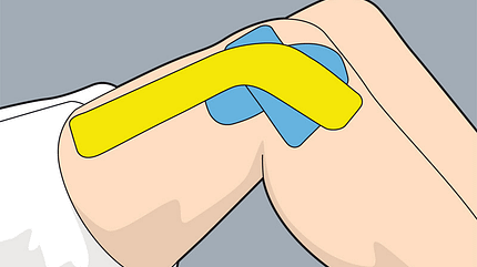 So tapen Sie richtig im Sport