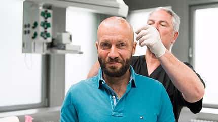 Men's Health Redakteur Oliver nach der Haartransplantation Men's Health Redakteur Oliver nach der Haartransplantation