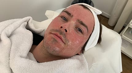 Mesotherapie im Test Mesotherapie im Test