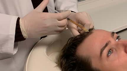 PRP-Behandlung für die Haare im Test PRP-Behandlung für die Haare im Test