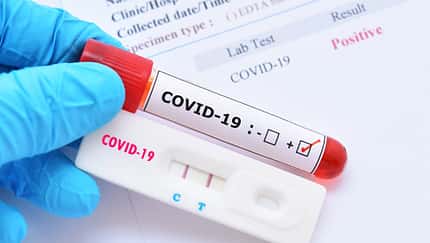 Ein positiver Coronatest bedeutet, dass du dich in Isolation begeben musst