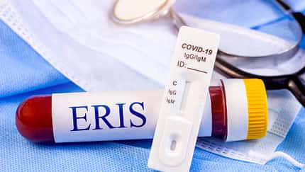 New,Infectious,Eris,Variant,Of,Covid,Disease,(eg.5),Sample,In
