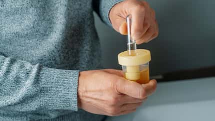 Die Farbe deines Urins sagt mehr über deine Gesundheit aus, als du vielleicht vermutest