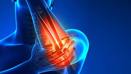 Schmerzen im Arm beim Training? Schmerzen im Arm beim Training?