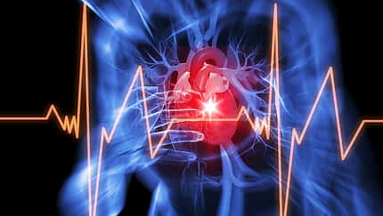 Herzinfarkt: 4 lebensrettende Ratschläge