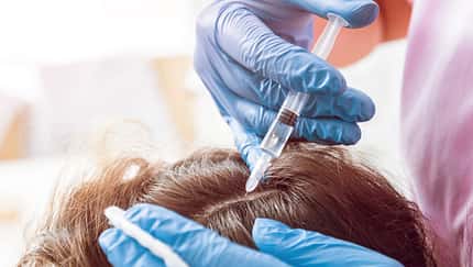 So hilft Blut gegen Haarausfall