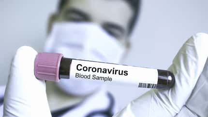 So schützt du dich wirklich vor dem Coronavirus