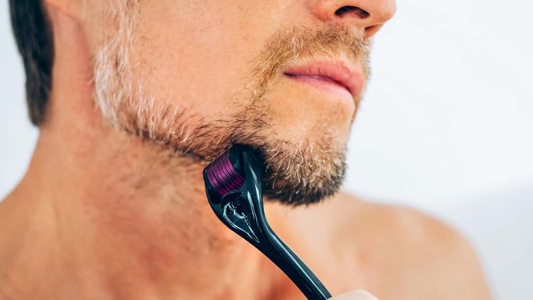 Dermaroller Für Haar- & Bartwachstum – 540 Titan-Microneedles, 0,75 Mm | Für Gesicht, Kopfhaut, Körper