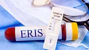 New,Infectious,Eris,Variant,Of,Covid,Disease,(eg.5),Sample,In