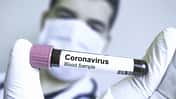 So schützt du dich wirklich vor dem Coronavirus