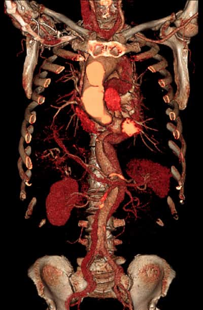Endokrines System Endokrines System